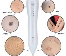 Xal,Ziyil yandırmaq üçün lazer