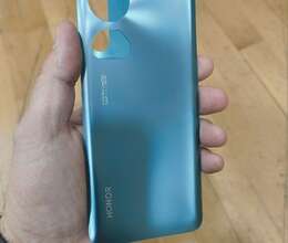 "Honor 90 Emerald" arxa qapağı