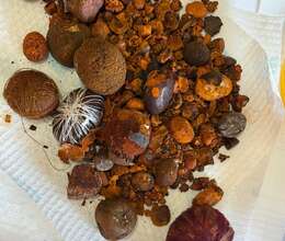 İnəyin öd daşını alıram