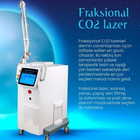 Lazer aparatı Fraksional CO2 – Biznes üçün avadanlıq – ucuztap.az