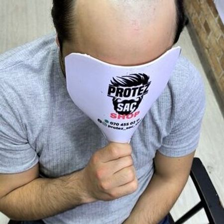 Protez Saç – Azərbaycan – ucuztap.az