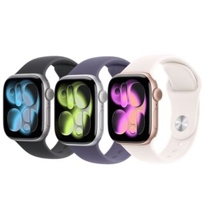 Apple Watch Series 11 Aluminum Rose Gold 46mm – Bakı – ucuztap.az