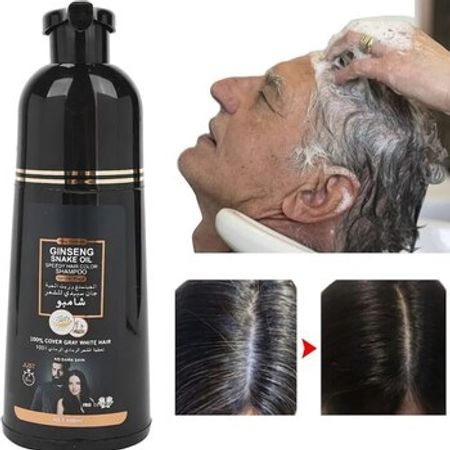 Saç qaraldan şampun – Bakı – ucuztap.az