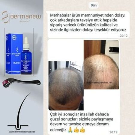 Dermanew saç losyonu – Sağlamlıq və gözəllik – ucuztap.az