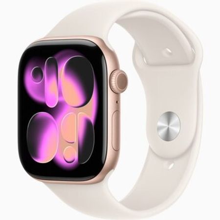 Apple Watch Series 11 Aluminum Rose Gold 46mm – Bakı – ucuztap.az